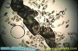 القصبات الهوائية لشغالة نحل العسل وبها أعداد هائلة من الأكارين