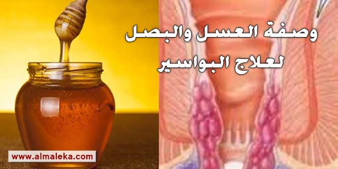 علاج البواسير بالعسل